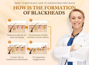 Blackhead Remove Facial Moisturizing Mask - Easy Pickins Store