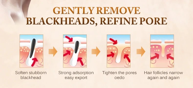 Blackhead Remove Facial Moisturizing Mask - Easy Pickins Store